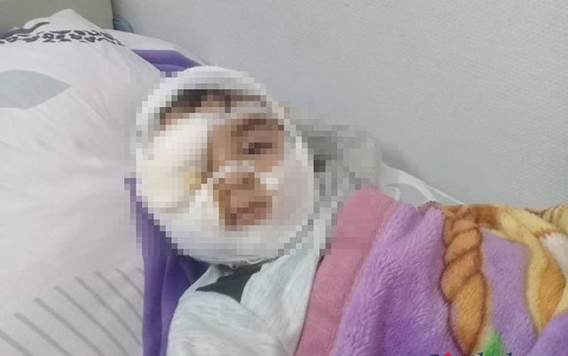 В Баку собака раскромсала лицо 4-летнему ребенку