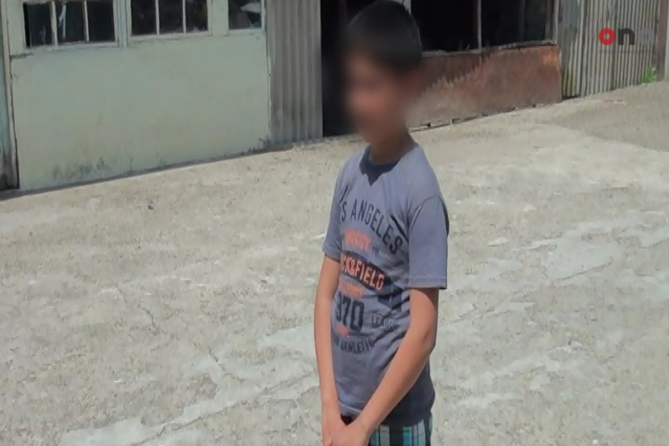 В Азербайджане бездомная собака укусила 11-летнего ребенка