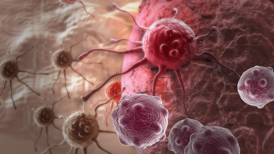 Немецкий онколог назвал самый эффективный метод борьбы с раком