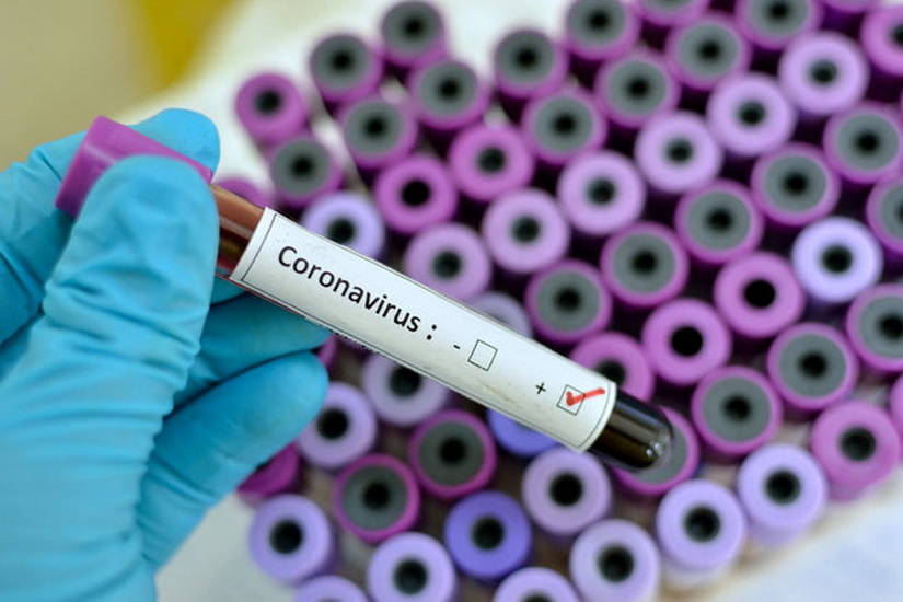 Россия разработала пять прототипов вакцины против коронавируса
