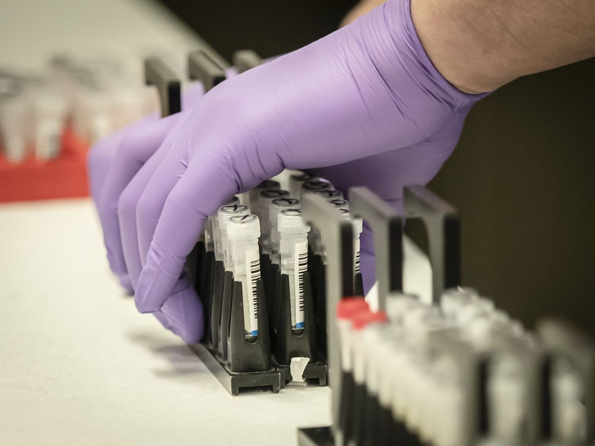 Работает в 10 раз быстрее: в США создали новый тест на коронавирус