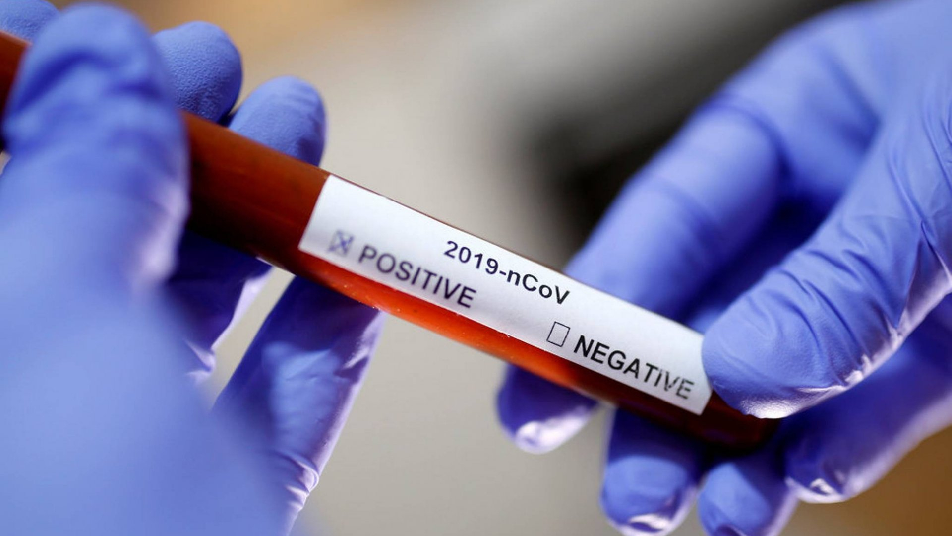 ВОЗ назвала стоимость тестов на коронавирус