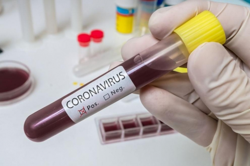 В Азербайджане еще 43 человека заразились коронавирусом