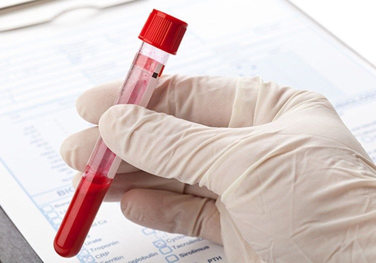TƏBİB: Случаи заражения коронавирусом через компоненты крови не подтверждены