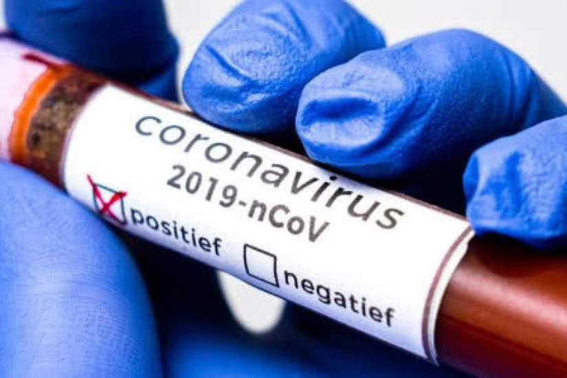 В Азербайджане более 66 тысяч человек протестированы на коронавирус