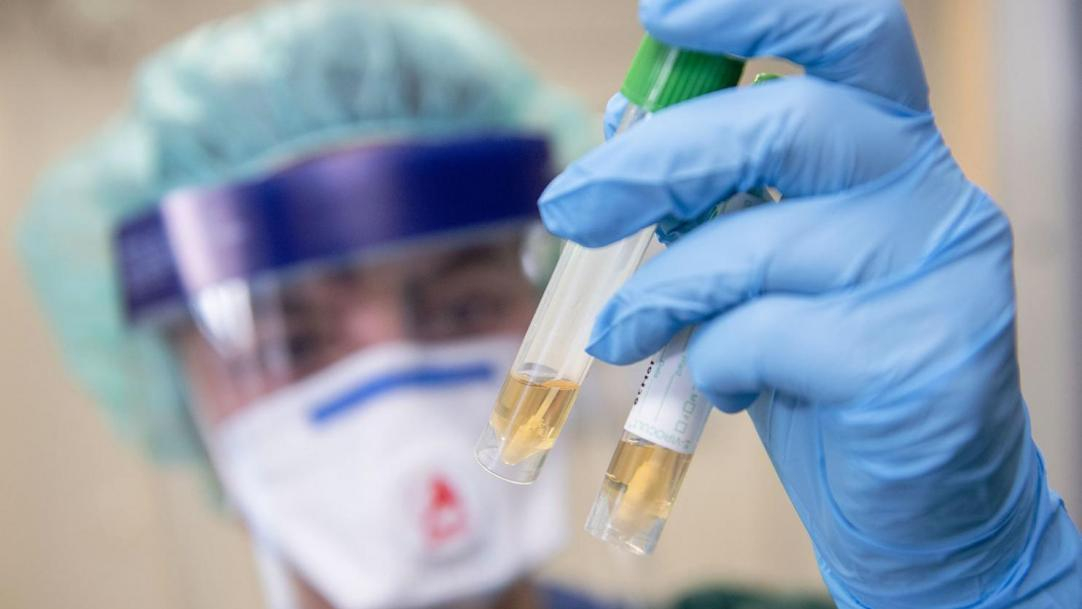 В Нахчыване коронавирус выявлен у 71 человека, 1 вылечился