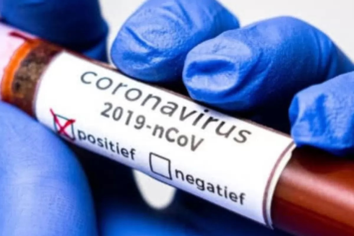 В Азербайджане выявлено еще 33 случая заражения коронавирусом, 23 человека вылечились