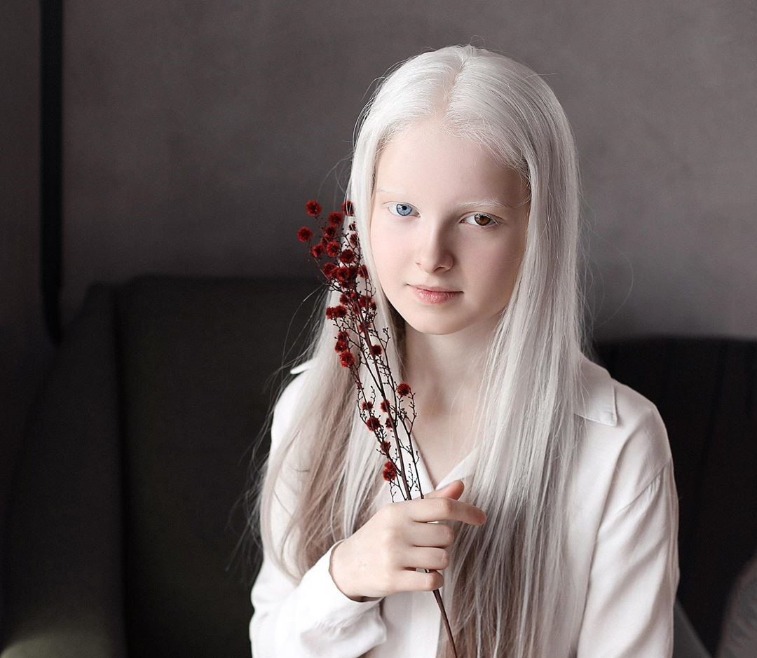 11-летняя девочка из Чечни удивила своей необычной красотой - ФОТО