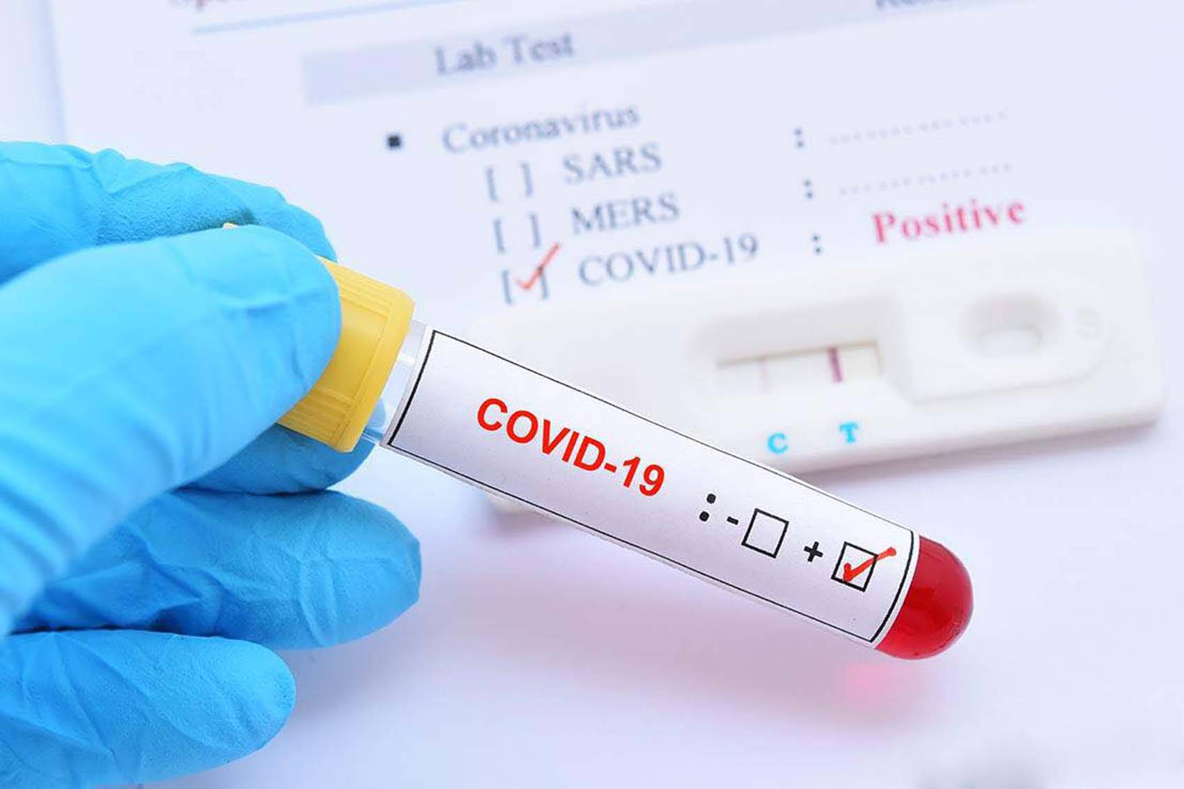 В Нахчыване коронавирус выявлен у 106 человек, скончались 2 человека