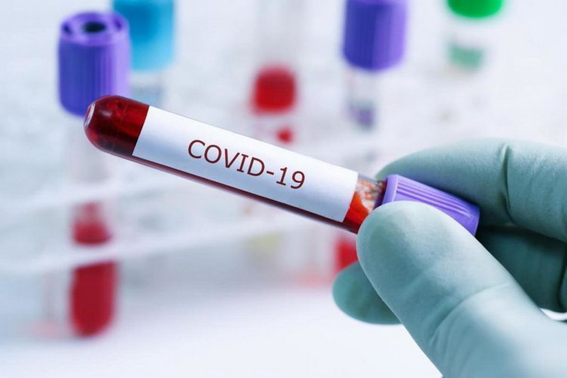 В Азербайджане выявлено еще 158 случаев заражения коронавирусом
