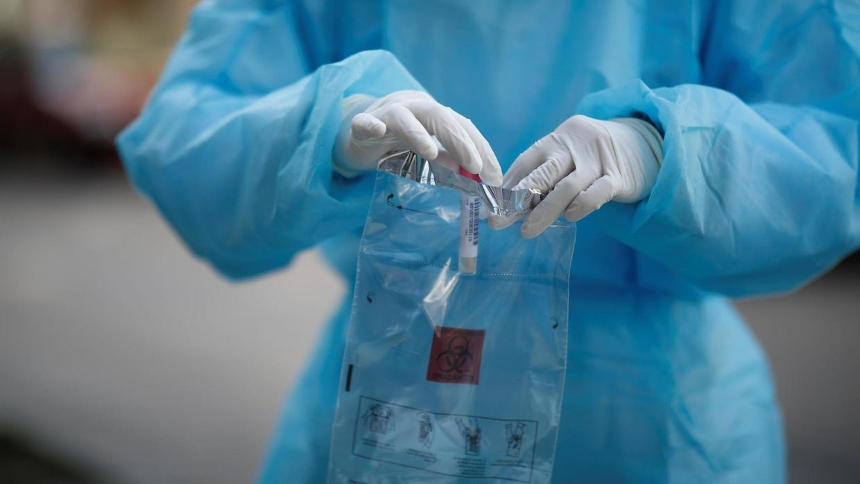В Азербайджане еще 127 человек заразились коронавирусом, 3 скончались