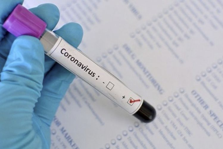 Опубликованы данные по заразившимся коронавирусом на утро 3 июня