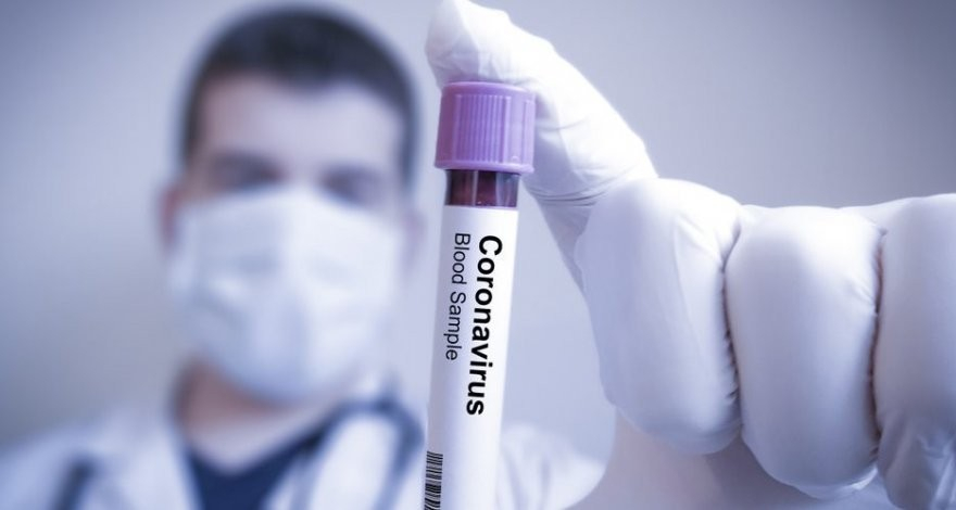 Еще один врач в Азербайджане заболел коронавирусом - ФОТО