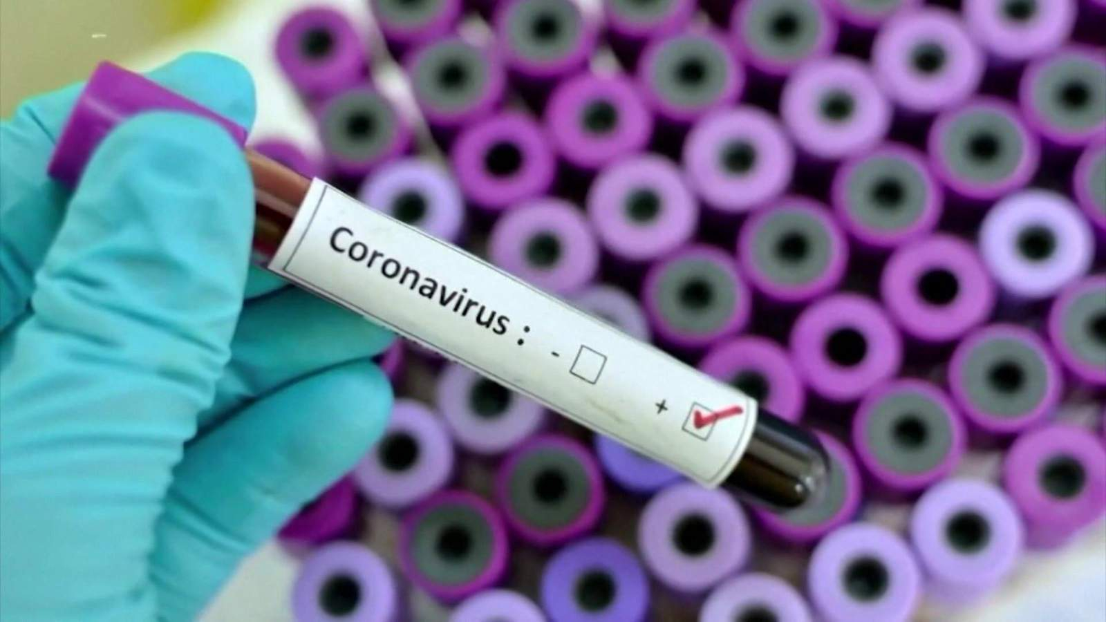 Опубликованы данные по заразившимся коронавирусом на утро 23 июня
