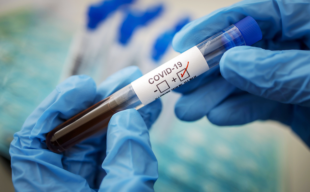 Эпидемиолог назвал сроки окончания пандемии коронавируса