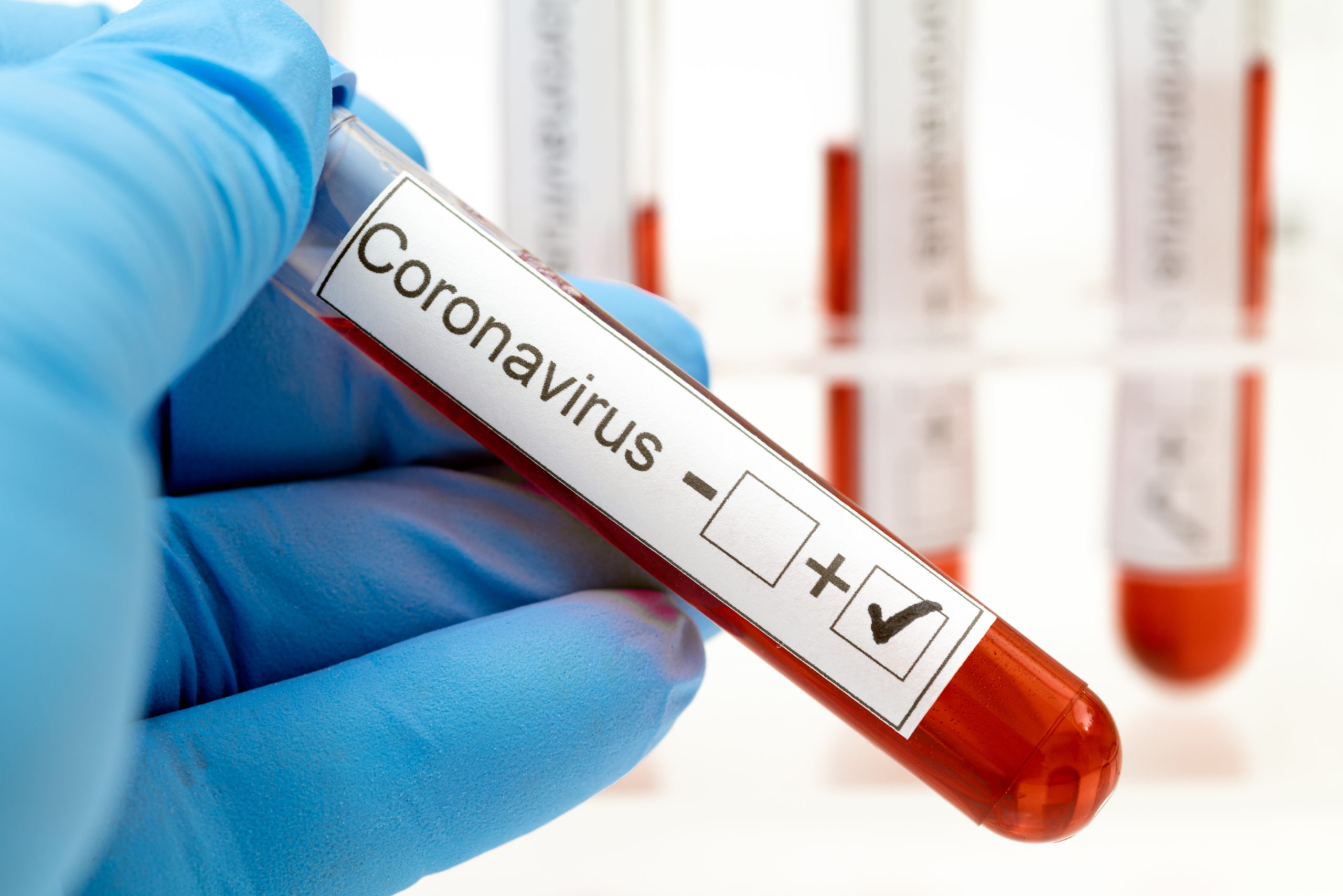 Опубликованы данные по заразившимся коронавирусом на утро 20 июля
