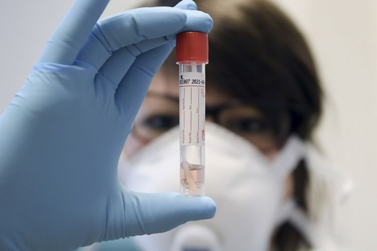 TƏBİB: Все тесты на коронавирус проведены государством бесплатно