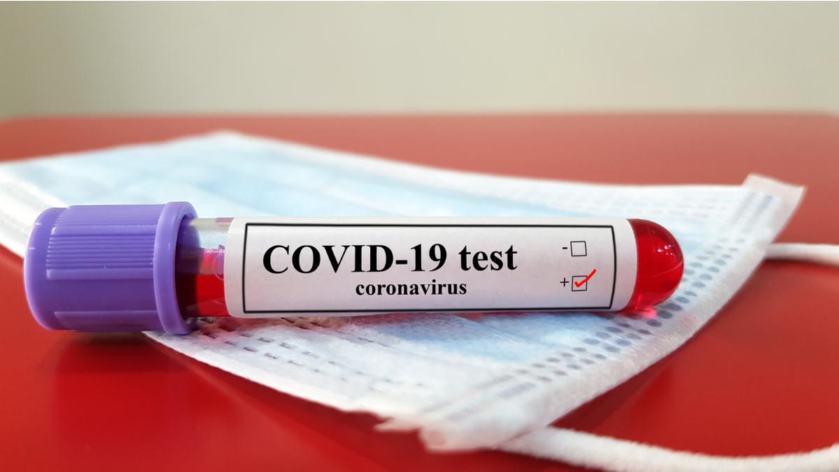 В Азербайджане 318 новых случаев заражения COVID-19
