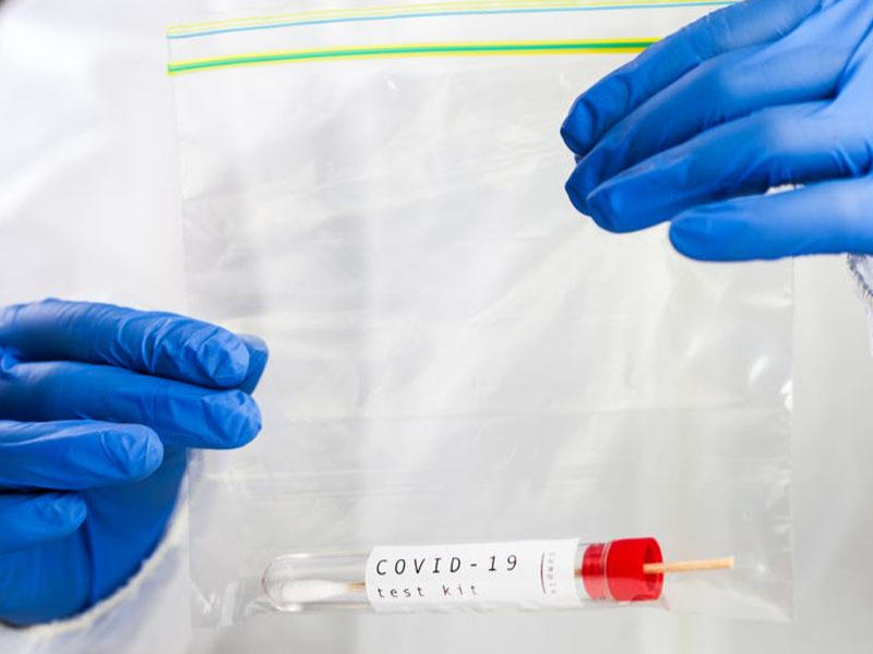 TƏBİB прокомментировало высказывания о нехватке тестов для выявления коронавируса