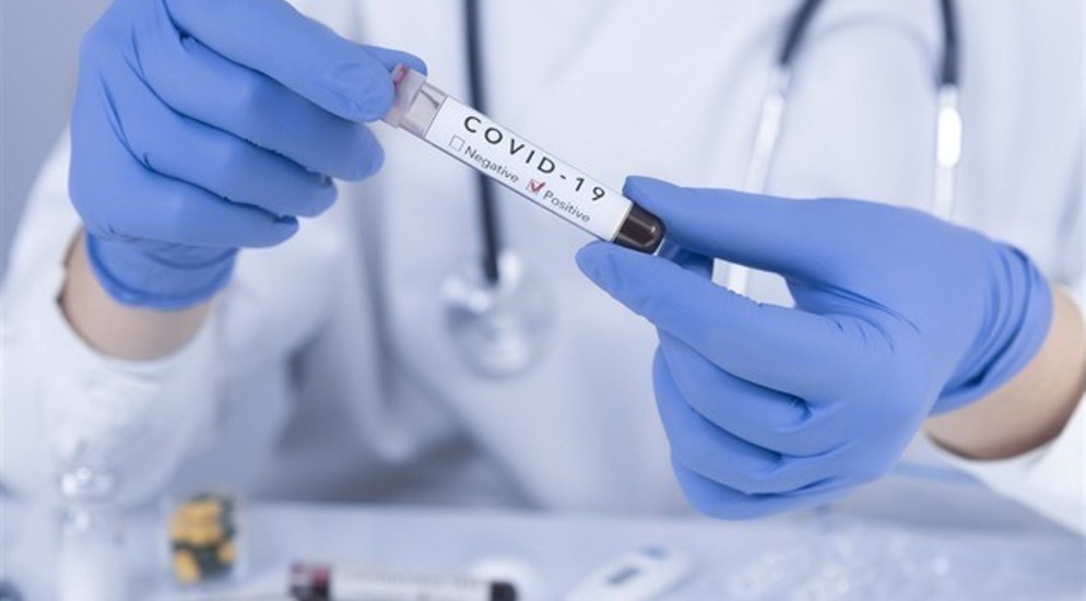 В Азербайджане выявлено еще 84 случая заражения коронавирусом, 3 скончались