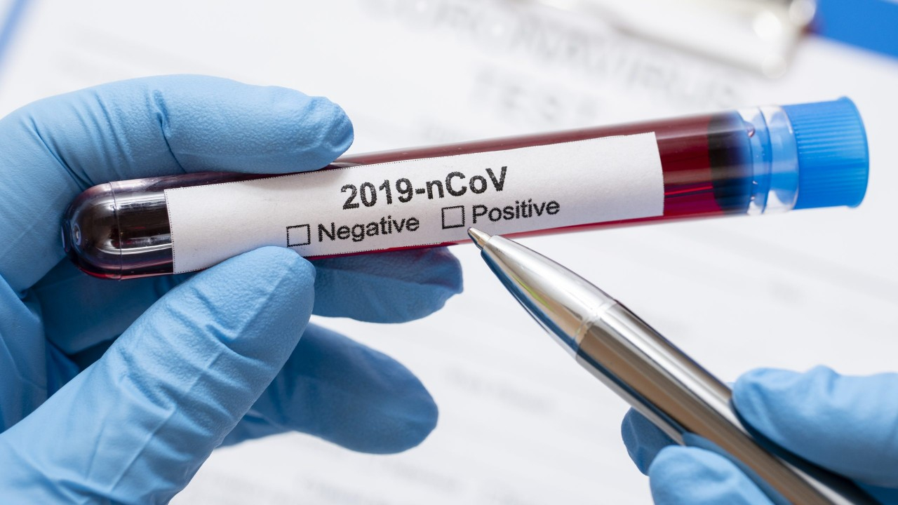 Опубликованы данные по заразившимся коронавирусом на утро 20 августа