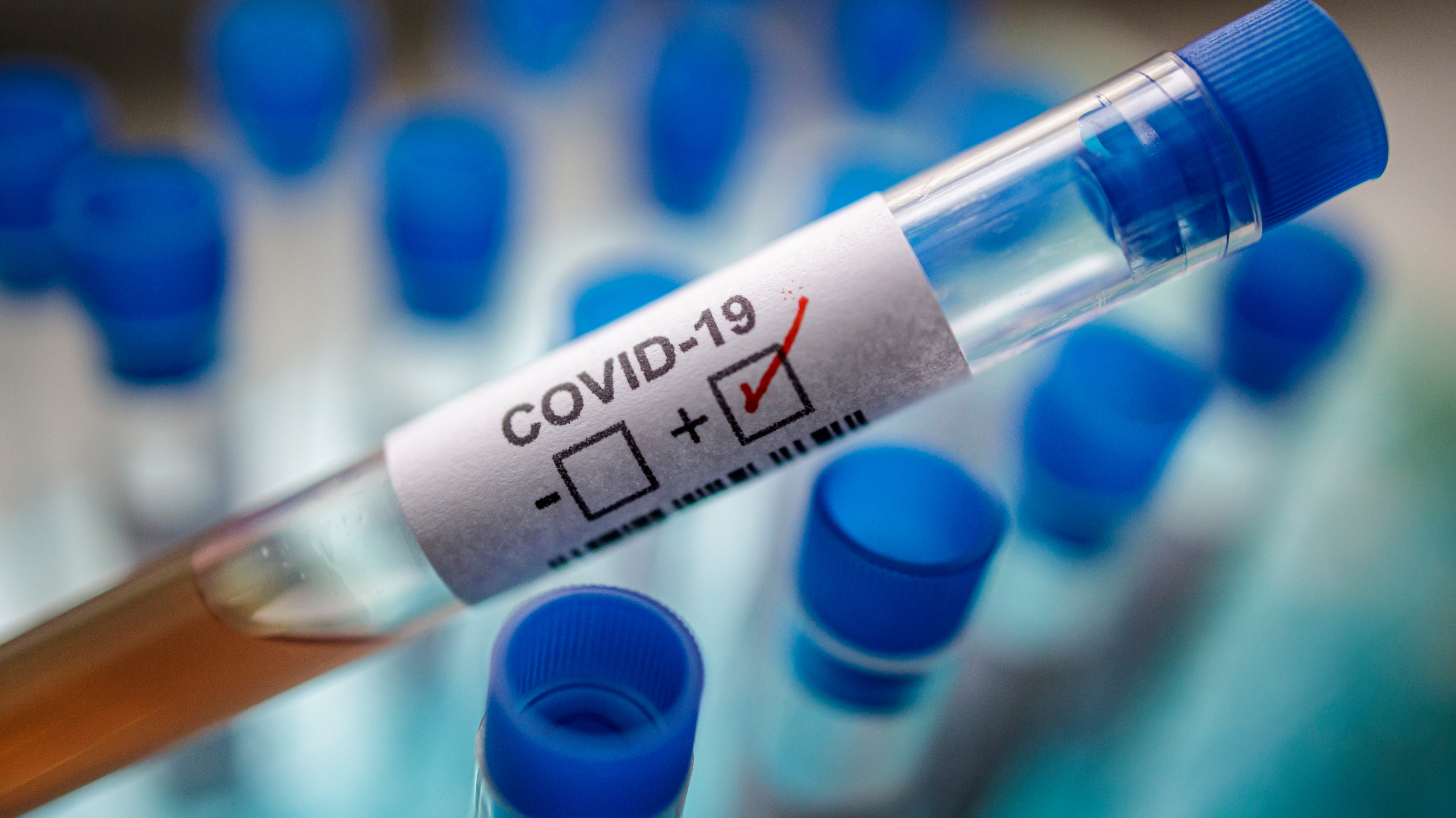 Опубликованы данные по заразившимся коронавирусом на утро 21 августа