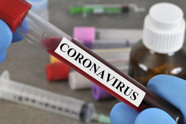 В Азербайджане выявлены 152 новых случая инфицирования COVID-19