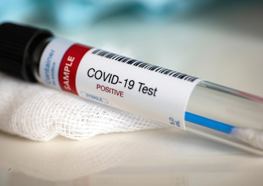 В Азербайджане обнародовано суточное количество заразившихся COVID-19 - ОФИЦИАЛЬНО