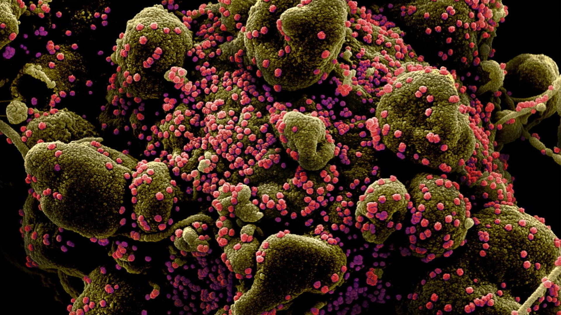 Ученые показали, как коронавирус проникает в человеческую клетку - ВИДЕО