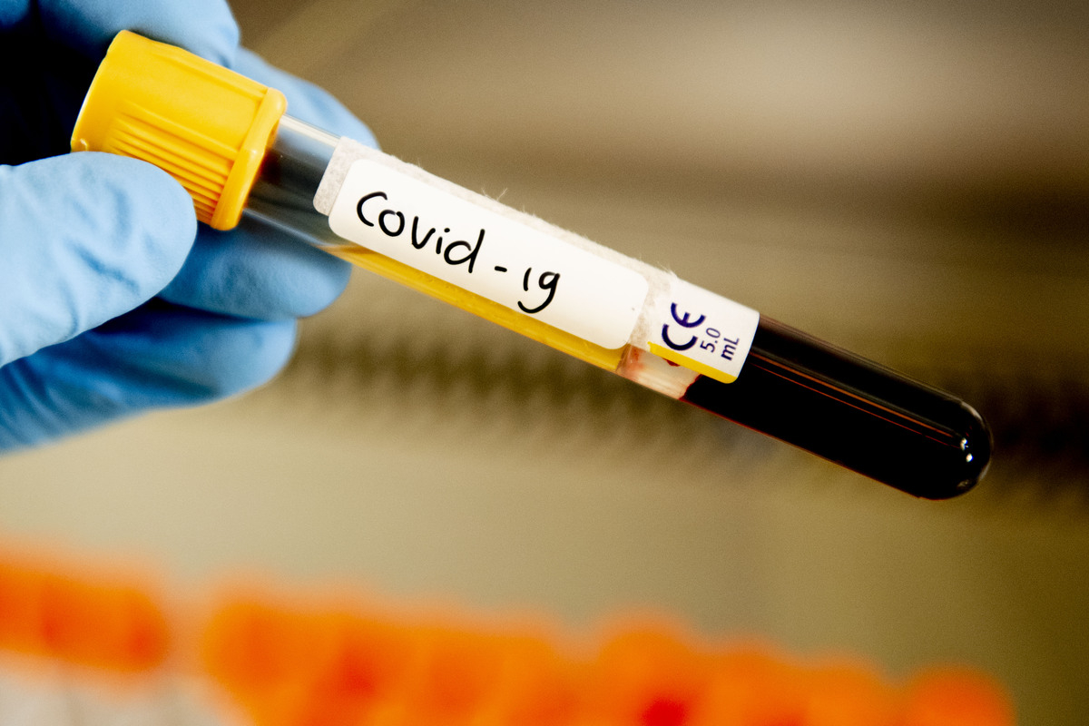 Обнародовано количество заразившихся коронавирусом в Азербайджане за сутки