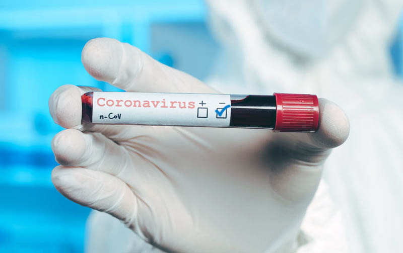 В Азербайджане вновь выросло количество зараженных коронавирусом - ФОТО