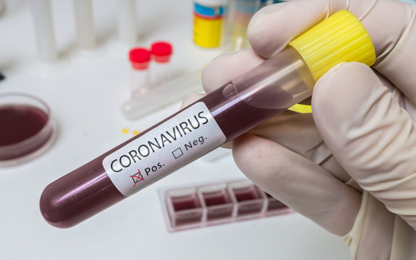 Новые данные по числу заболевших коронавирусом в Азербайджане - ФОТО