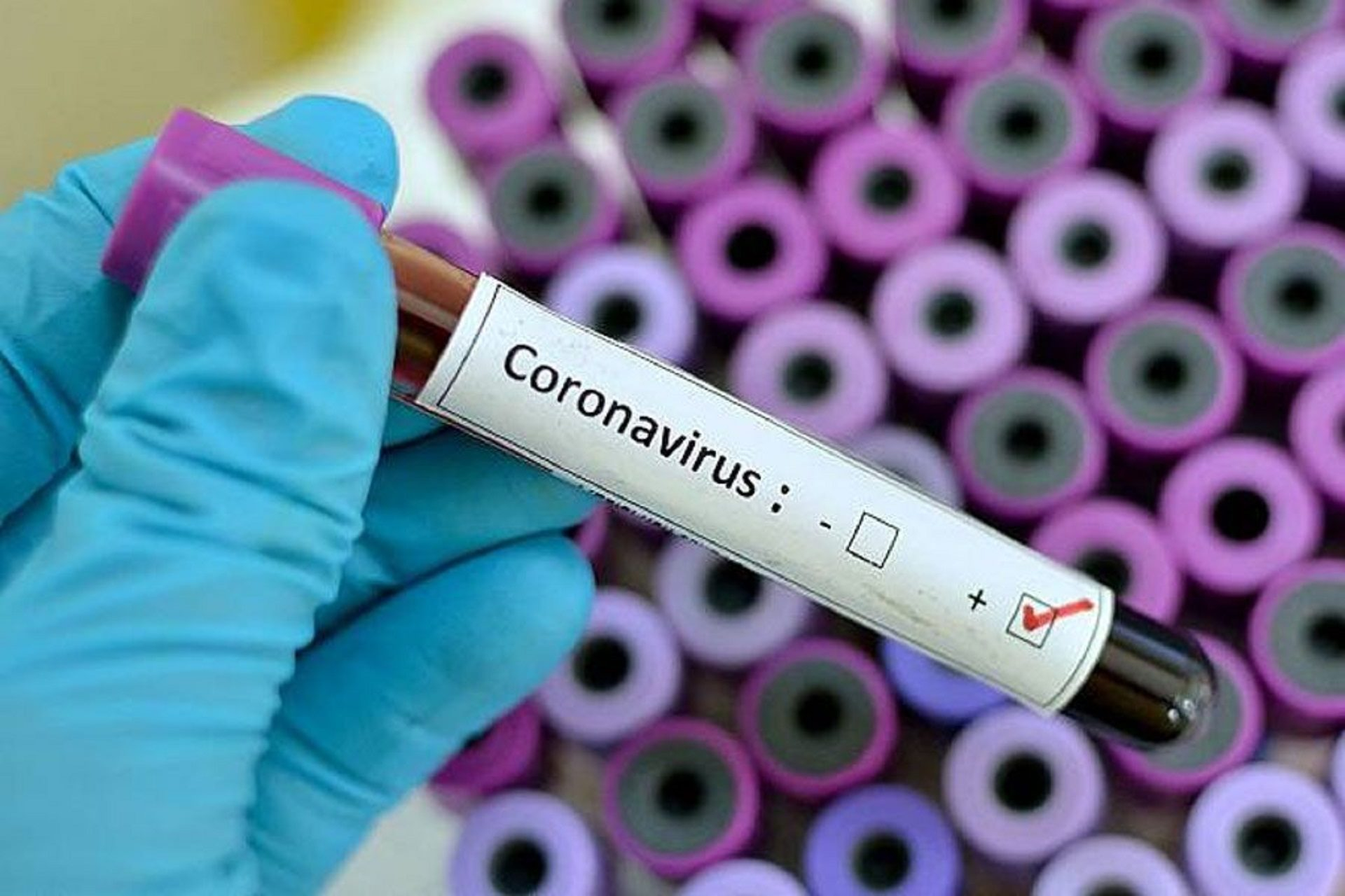 Опубликованы данные по заразившимся коронавирусом на утро 17 декабря