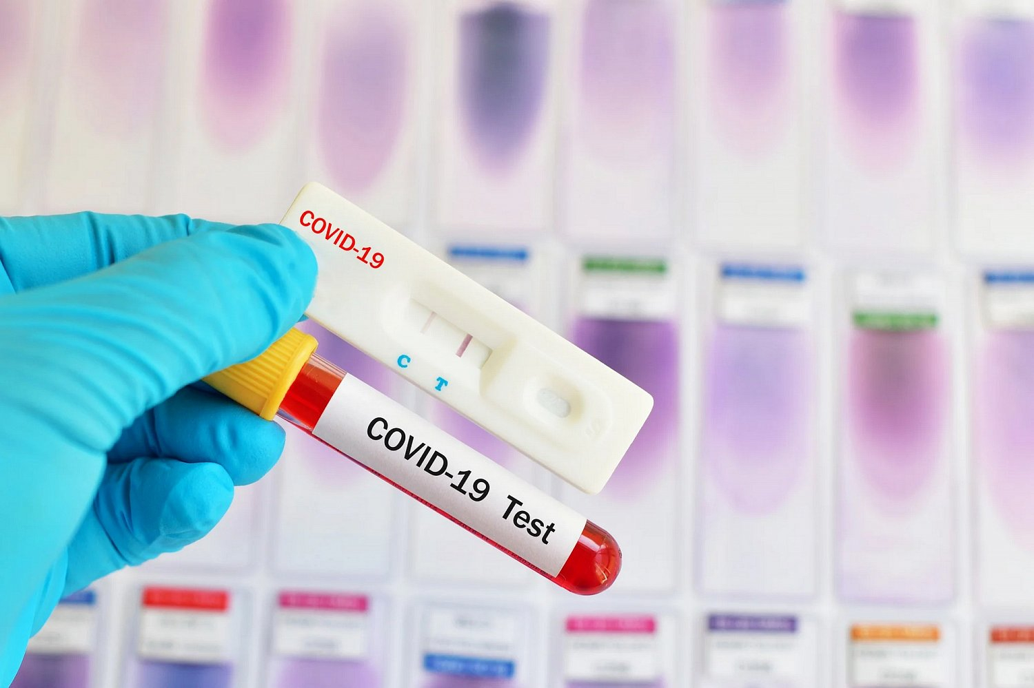 В Азербайджане резко увеличилось число инфицированных COVID-19 - ФОТО
