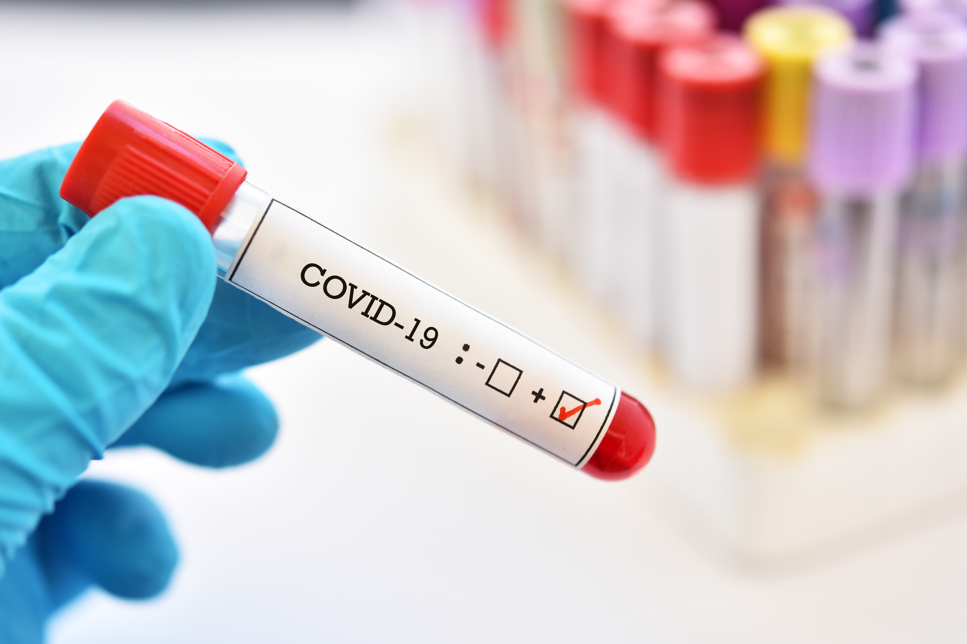 Обнародована последняя статистика по коронавирусу в Турции