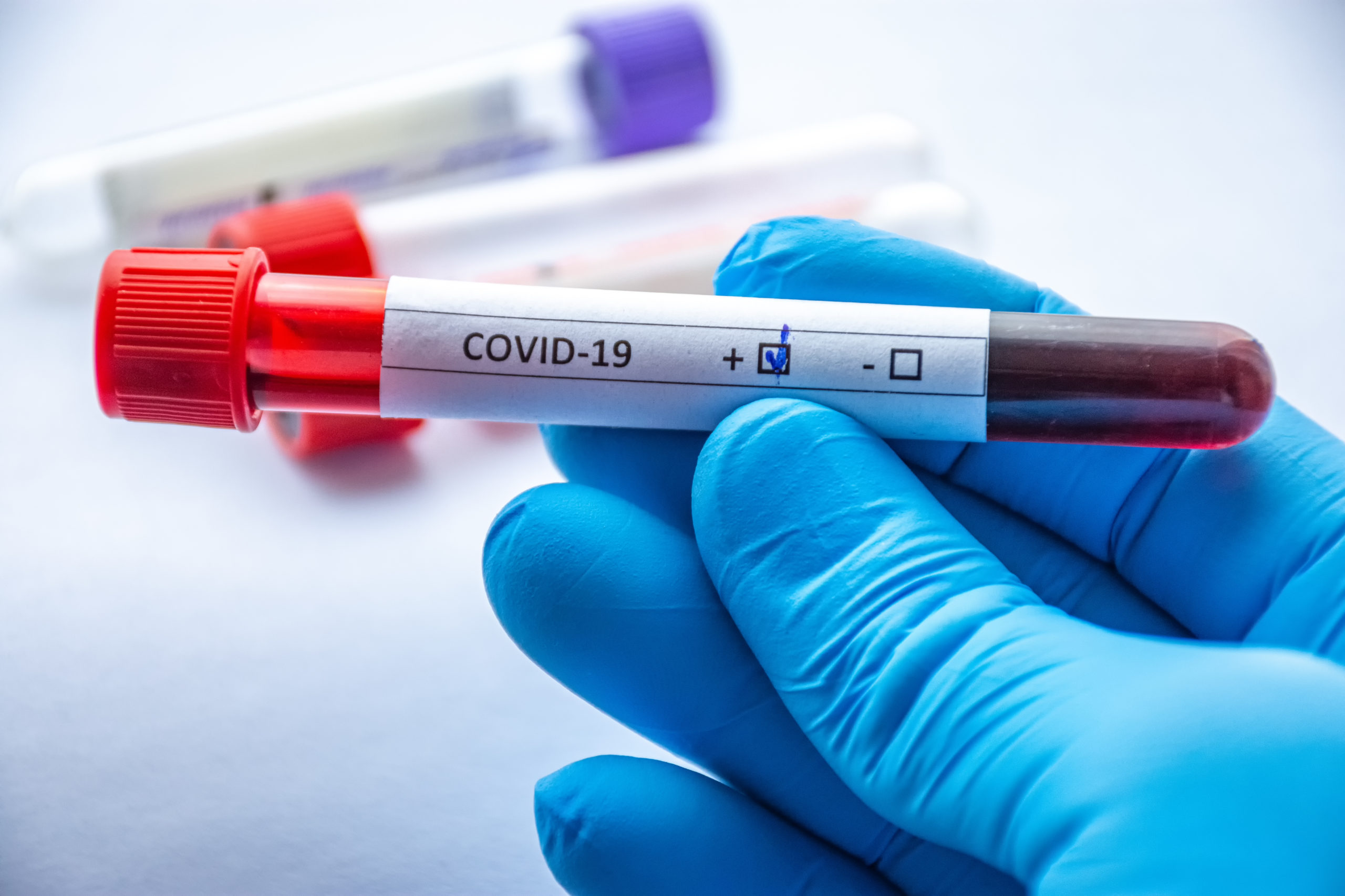 Обнародовано число заболевших коронавирусом на сегодня - ФОТО