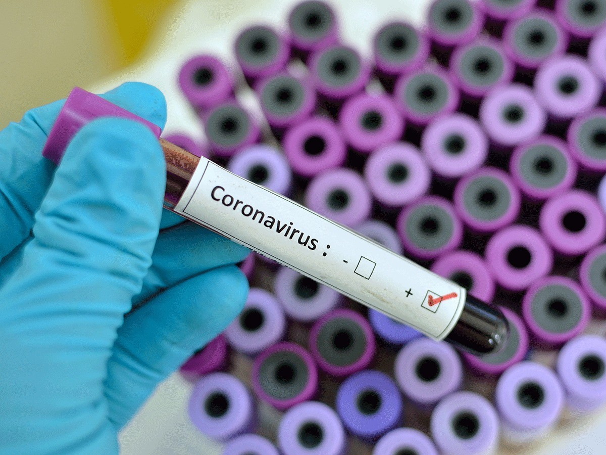 Опубликованы данные по заразившимся коронавирусом на утро 8 октября