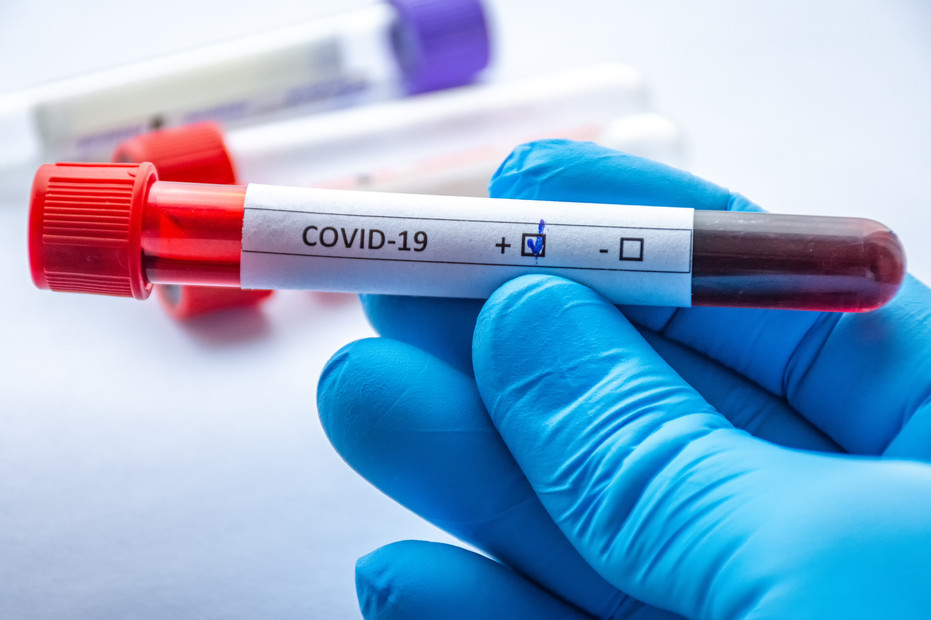 В Азербайджане за сутки выявили более 2 тысяч заразившихся COVID-19 - ФОТО