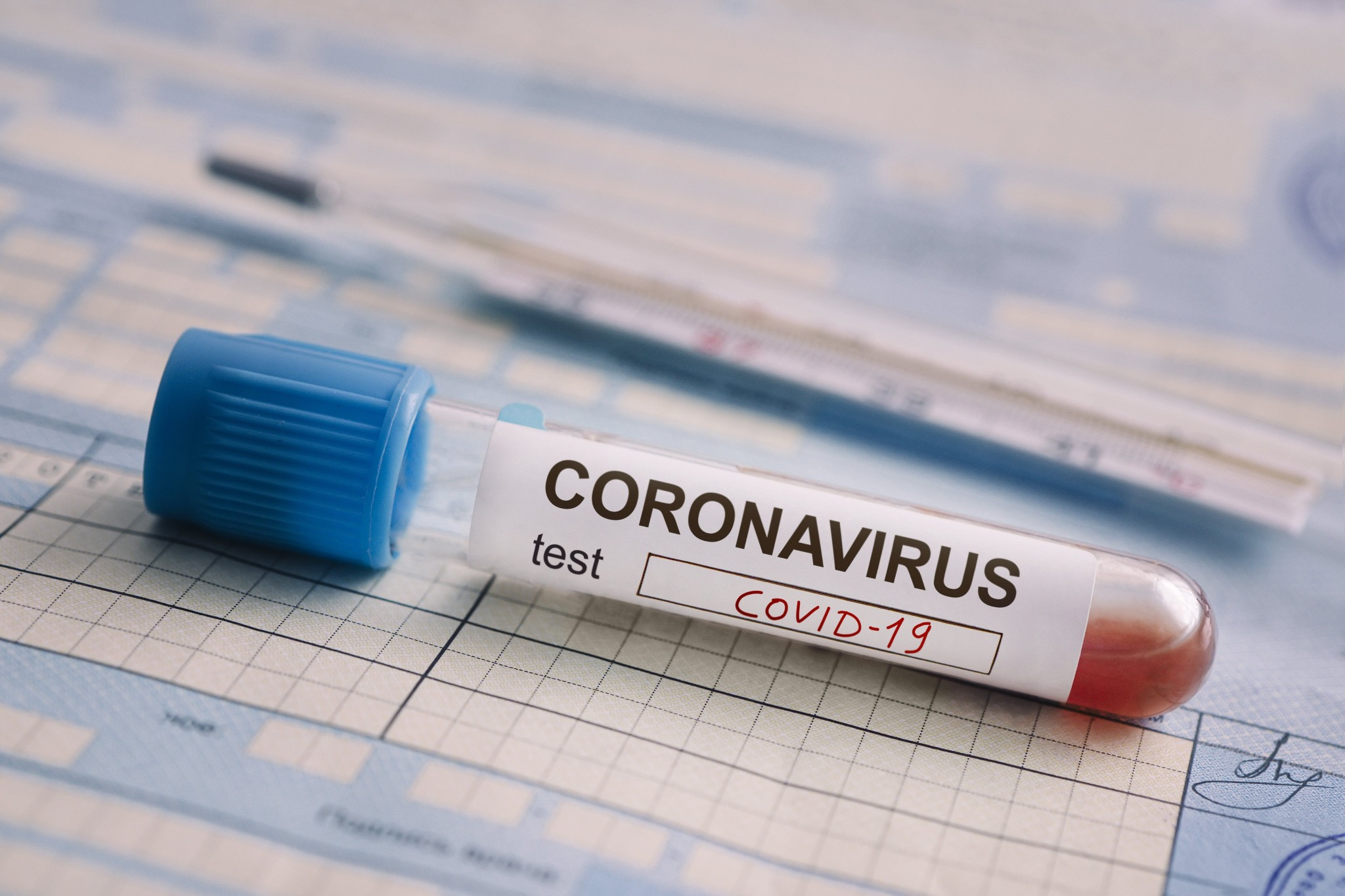 Обнародована информация о новых заболевших коронавирусом в Азербайджане - ФОТО