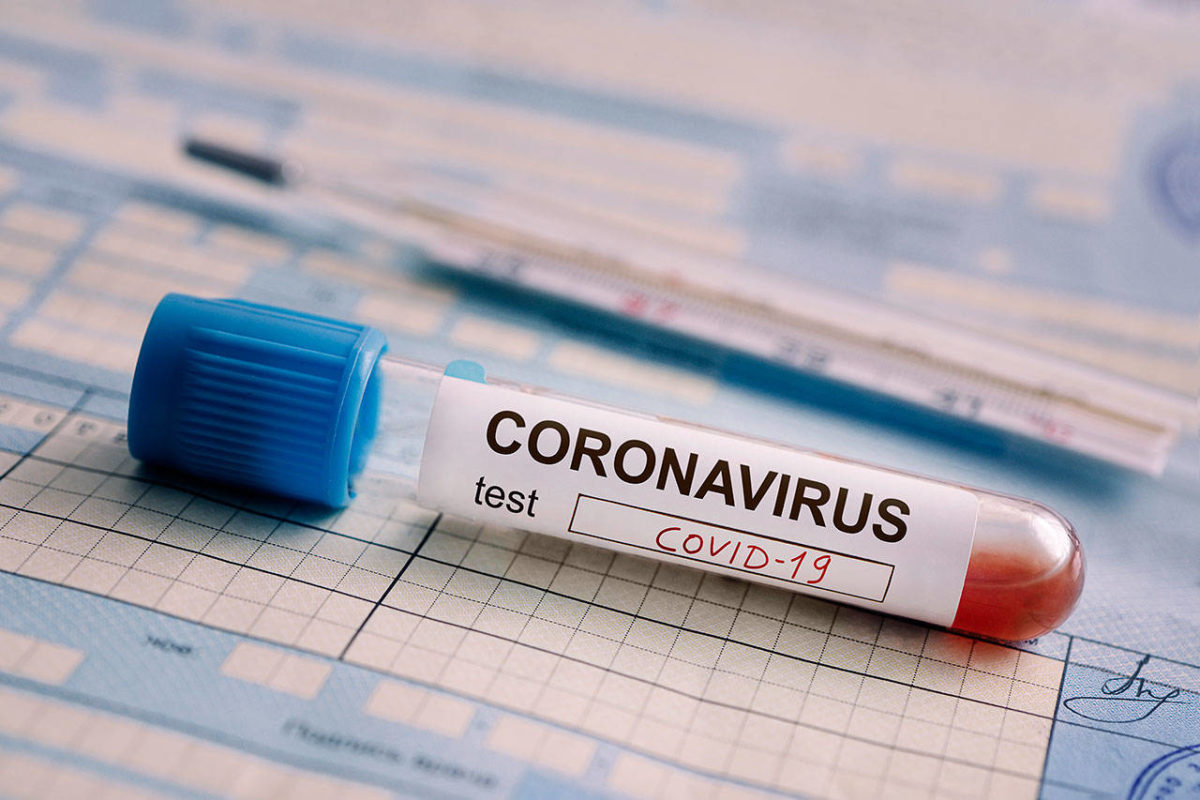 В Азербайджане за последние сутки от коронавируса скончались 10 человек - ФОТО