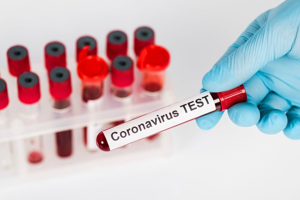 Названо число заразившихся коронавирусом в Азербайджане за сутки