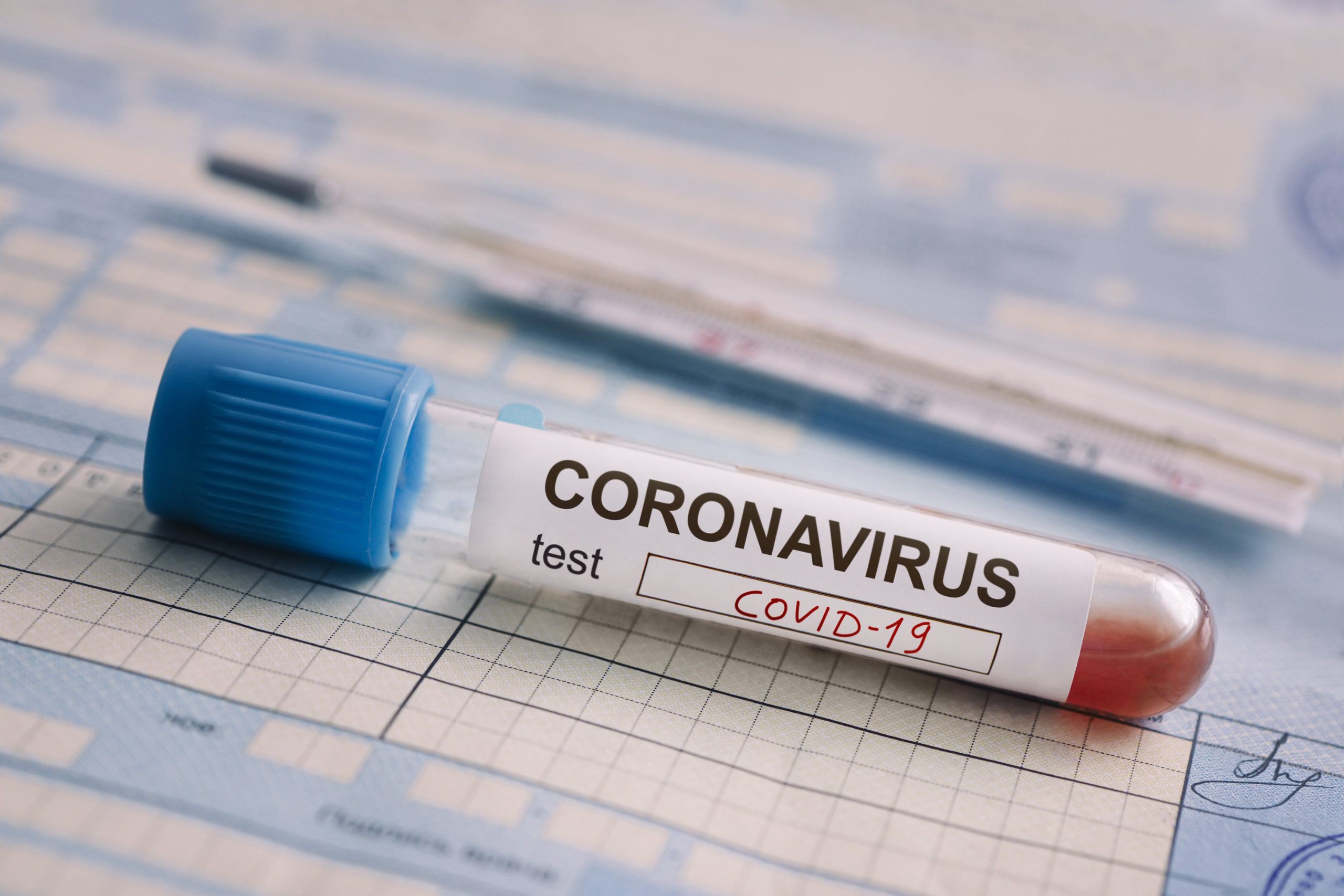Стало известно количество заболевших коронавирусом в Азербайджане за сутки - ФОТО