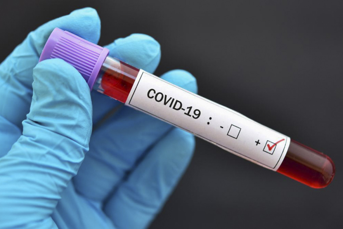 Стало известно, сколько человек в Азербайджане заразились COVID-19 за сутки - ФОТО
