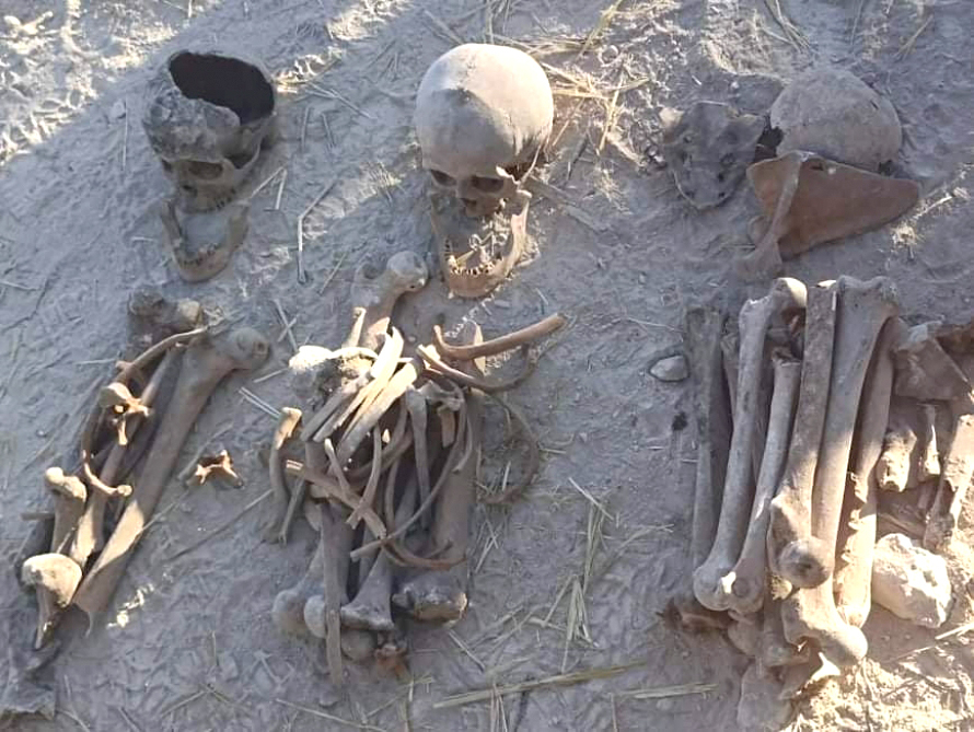 Экспертиза останков, найденных на высоте Фаррух, доказывает, что они принадлежат азербайджанцам - ВИДЕО