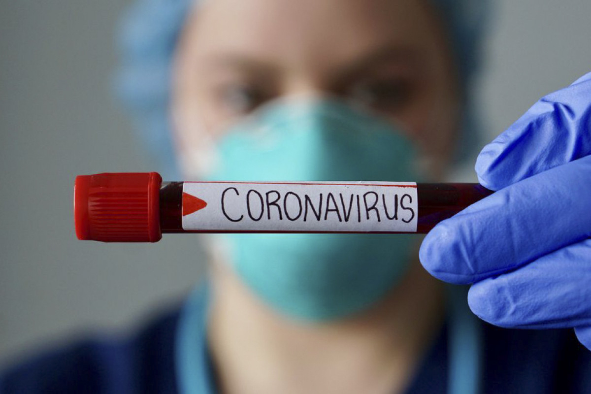 В Азербайджане еще 16 человек заразились коронавирусом