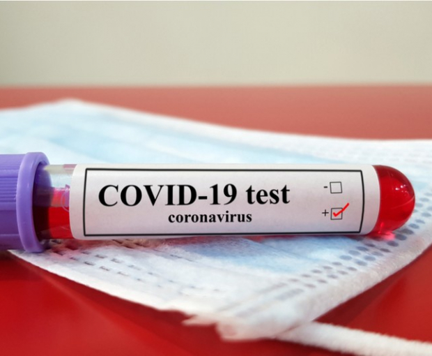 Названо число заразившихся коронавирусом в Азербайджане за сегодня - ФОТО