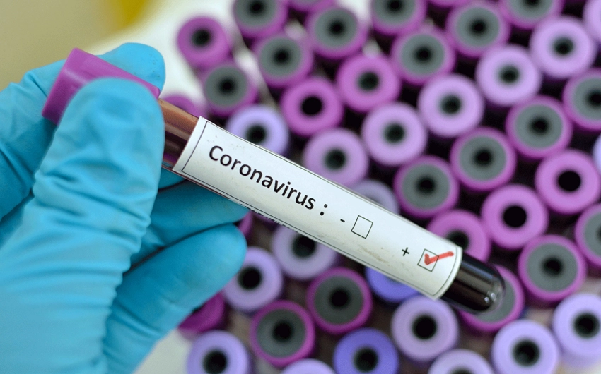 За сутки выявлено 164 случая заражения коронавирусом, трое скончались - ФОТО