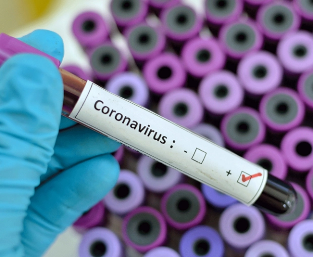За сутки выявлено 164 случая заражения коронавирусом, трое скончались - ФОТО