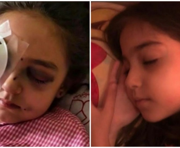 В Иране в результате открытого полицейскими огня девочка потеряла глаз - ФОТО