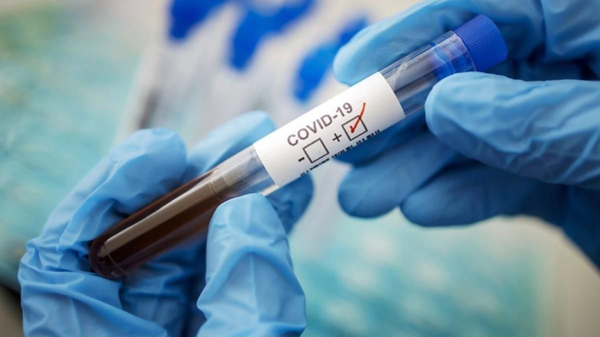 В Азербайджане за последние сутки коронавирусом заразились 24 человека - ФОТО